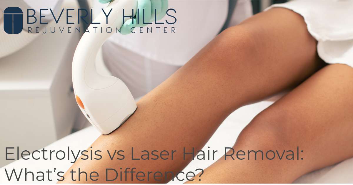 Electrolysis vs Laser Hair Removal What’s the Difference? Beverly